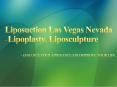 Best Liposuction in Las vegas PowerPoint PPT Presentation