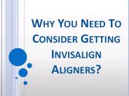 Why You Need To Consider Getting Invisalign Aligners?