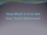 How Much is It to Get Your Teeth Whitened?