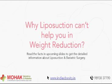 Liposuction Vs Bariatric Surgery - Dr Mohit Bhandari