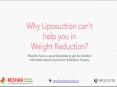 Liposuction Vs Bariatric Surgery - Dr Mohit Bhandari PowerPoint PPT Presentation