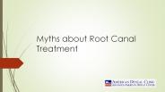 Myths about Root Canal Treatment