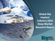 Global Hip Implant Industry Research Report 2016