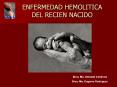 ENFERMEDAD HEMOLITICA DEL RECIEN NACIDO PowerPoint PPT Presentation