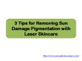 3 Tips for Removing Sun Damage Pigmentation with Laser Skincare PowerPoint PPT Presentation