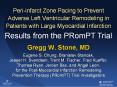 Peri-infarct Zone Pacing to Prevent Adverse Left Ventricular Remodeling in Patients with Large Myocardial Infarction PowerPoint PPT Presentation