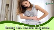 Bleeding Piles Treatment In Ayurveda