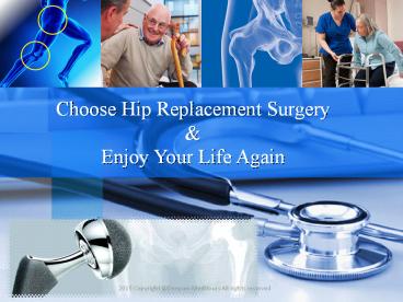 Hip replacement surgery India