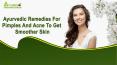 Ayurvedic Remedies For Pimples And Acne To Get Smoother Skin