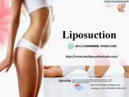All You Need to Know About Liposuction