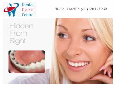 Top Dental Clinic in East Delhi - Dentaltreatmentdelhi