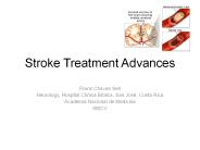 Stroke Treatment Advances