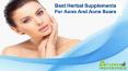 Best Herbal Supplements For Acne And Acne Scars