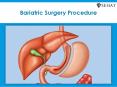 Bariatric Surgery Procedure PowerPoint PPT Presentation