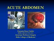 ACUTE%20ABDOMEN