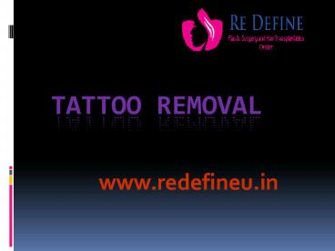 Tattoo Removal Surgery In Hyderabad