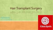 Hair Transplant Turkey