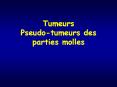 Tumeurs Pseudo-tumeurs des parties molles PowerPoint PPT Presentation