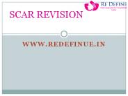 Scar Revision Surgery in Redefine