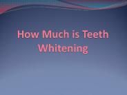 How Much is Teeth Whitening