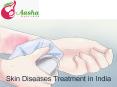 Skin Diseases Treatment in Delhi India PowerPoint PPT Presentation