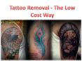 Tattoo Removal Chandigarh - The Low Cost Way PowerPoint PPT Presentation