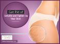 The Role Skin Tightening in Cellulite Reduction PowerPoint PPT Presentation