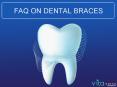 FAQ: Care for Teeth while wearing braces PowerPoint PPT Presentation