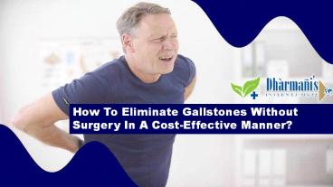 How To Eliminate Gallstones Without Surgery In A Cost-Effective Manner?
