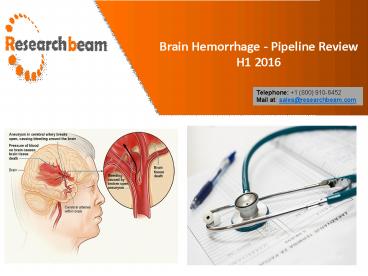 Top Success Tips From Experienced About Brain Hemorrhage