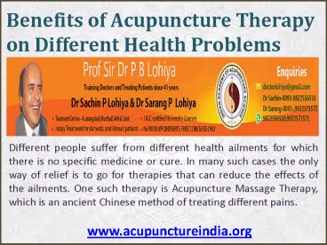 Benefits of Acupuncture Therapy (1)