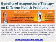 Benefits of Acupuncture Therapy (2)