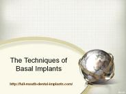 The Techniquesof Basal Implants