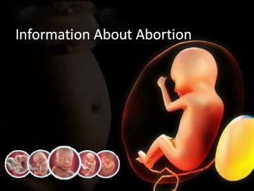 Get Information About Abortion