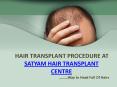 HAIR TRANSPLANT PROCEDURE AT SATYAM HAIR TRANSPLANT CENTRE