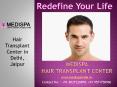 Hair Transplant in Delhi | Hair Transplant in India PowerPoint PPT Presentation