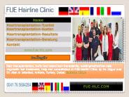 Hair Transplant Istanbul (1)
