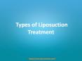 Liposuction Surgery by Sai Cosmetics - Hair Transplant Surgeon & Skin Care Treatment in Pune PowerPoint PPT Presentation