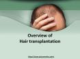 Overview of Hair Transplantation by Sai Cosmetics - Hair Transplant Surgery & Skin Care Treatment in Pune PowerPoint PPT Presentation