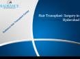 Hair Transplantation in Hyderabad | Radiance PowerPoint PPT Presentation