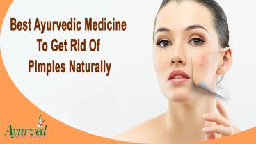 Best Ayurvedic Medicine To Get Rid Of Pimples Naturally
