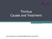 Tinnitus Causes