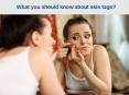What you should know and take care about skin tags PowerPoint PPT Presentation