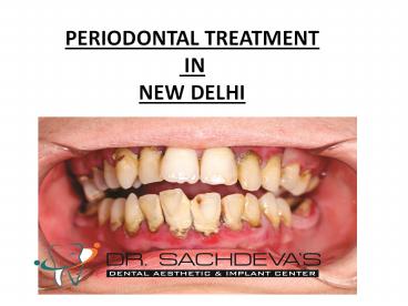Laser Dentistry Training Course in Delhi