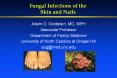 Fungal Infections of the Skin and Nails PowerPoint PPT Presentation