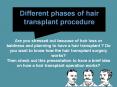 Different Phases of Hair Transplant Procedure PowerPoint PPT Presentation
