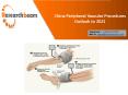 Peripheral Vascular Disease Surgery Recovery Analysis of China PowerPoint PPT Presentation