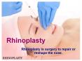 Nose Reshaping in Delhi - Rhinoplasty Surgery in Delhi PowerPoint PPT Presentation