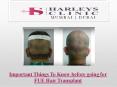 Important Things To Know before going for FUE Hair Transplant PowerPoint PPT Presentation
