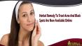 Herbal Remedy To Treat Acne And Black Spots Are Now Available Online